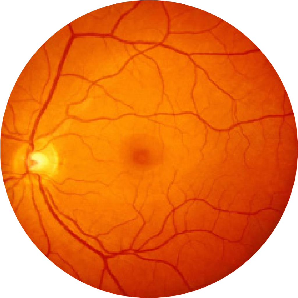 geographischeatrophie.de - healthy_fundus